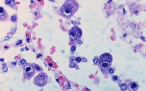 Citomegalovirus, il Sant’Anna scopre come prevenire l’incubo delle future mamme Causio ginecologo eterologa Italia